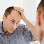 does cocaine make your hair fall out